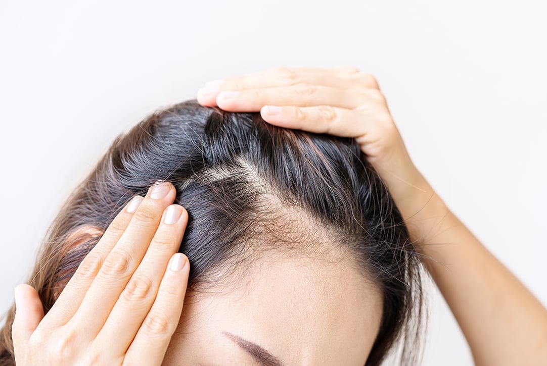 How to Regrow Hair on a Bald Spot - KeraHealth