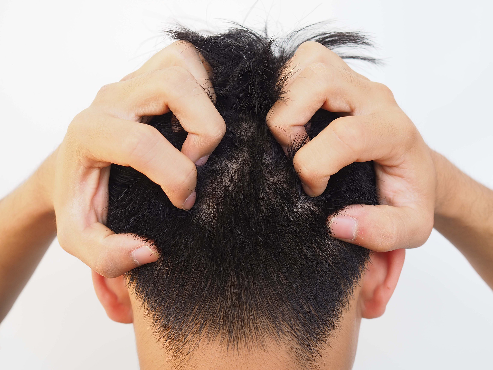 Dry or Itchy Scalp